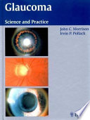 Glaucoma book cover