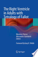 The Right Ventricle in Adults with Tetralogy of Fallot book cover