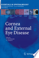 Cornea and External Eye Disease book cover