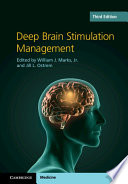 Deep Brain Stimulation Management book cover